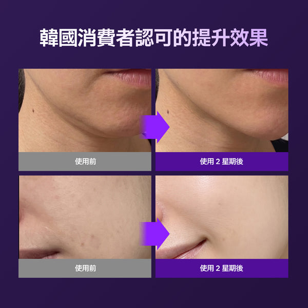EOA NAD+ Collagen Lifting Hydrogel Mask