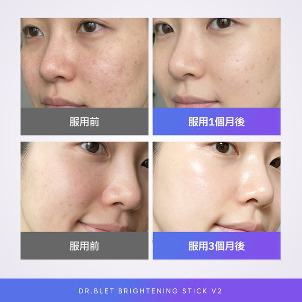 dr.blet 白玉美白粉 v2
